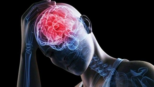 Características de migraña crónica posterior a bloqueo pericraneal con anestésicos y dexametasona en adultos 