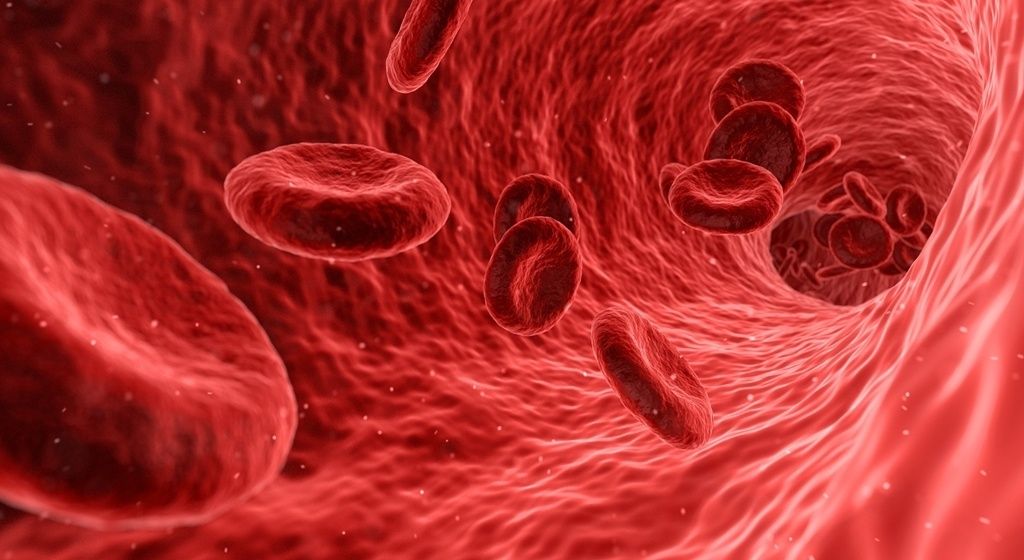 La anemia está presente en un tercio de los pacientes que se someten a una operación quirúrgica