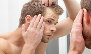 La Comisión Europea aprueba Litfulo® para adolescentes y adultos con alopecia areata grave