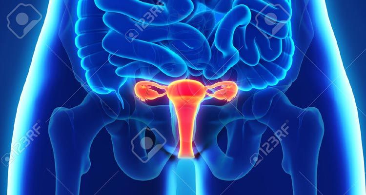 El cáncer de ovario no manifiesta síntomas fáciles de identificar y se confunden con cualquier otra enfermedad