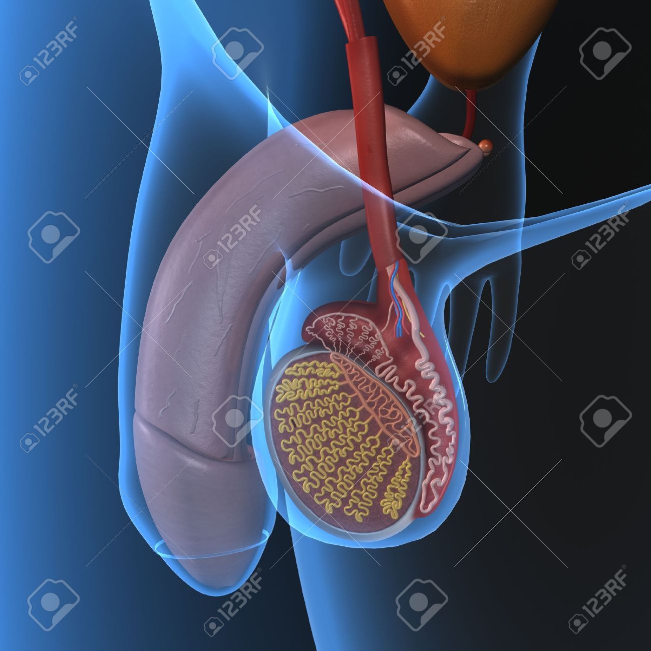 El implante de prótesis de pene soluciona la disfunción eréctil en el 90% de los casos