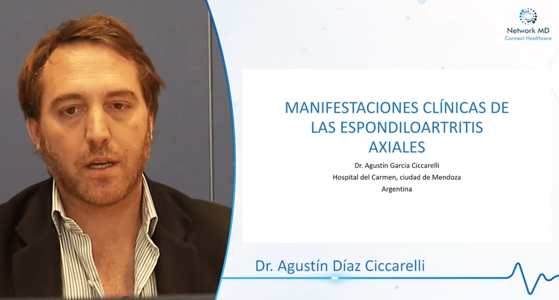 Video: Manifestaciones Clinicas de las Espondilitis Axiales. (CME)
