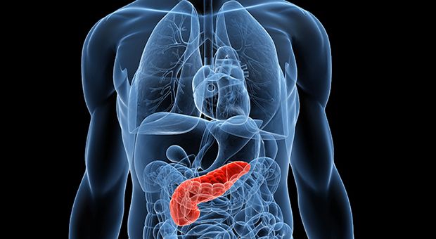 Pancreatitis aguda asociada a balón intragástrico: reporte de caso y revisión de la literatura