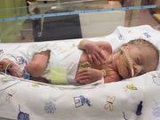 El nacimiento prematuro se relaciona con un mayor riesgo de enfermedad obstructiva de las vías respiratorias en la edad adulta