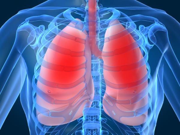 El aumento asimétrico del diámetro de la arteria pulmonar no siempre es secundario a hipertensión arterial pulmonar