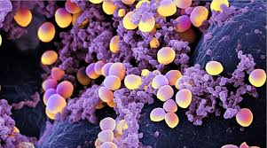 Infección por Staphylococcus lugdunensis: descripción de 44 casos 
