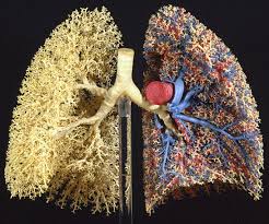 Microlitiasis alveolar pulmonar: Uso de gammagrafía ósea en la valoración diagnóstica. Reporte de 5 casos