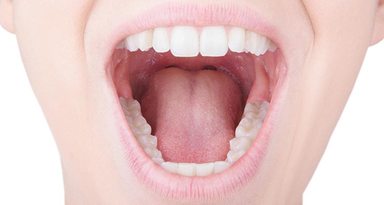 Úlcera eosinofílica de la lengua