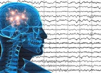Aspectos electroclínicos de la epilepsia temporal mesial
