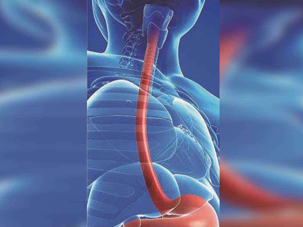Prevalencia de esofagitis eosinofílica: estudio multicéntrico en población pediátrica evaluada en 36 centros de gastroenterología de América Latina