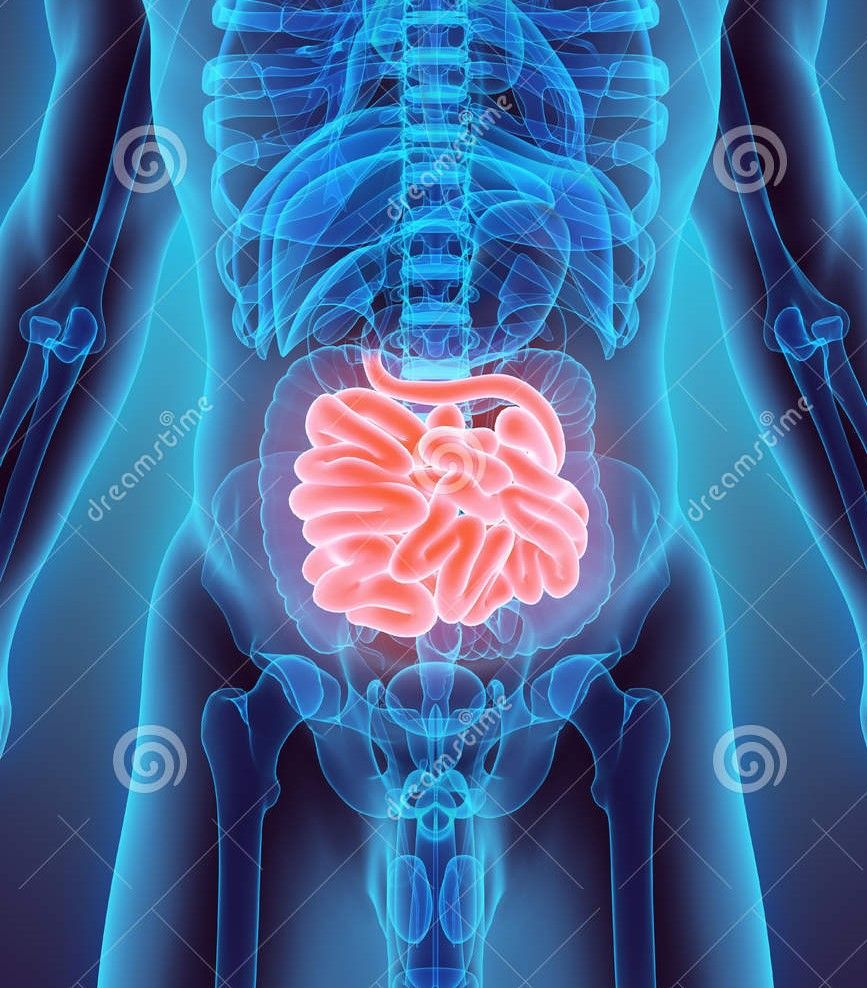 Tumor del estroma gastrointestinal (GIST) de yeyuno: caso clínico