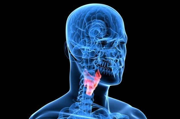 Neuropatía laríngea y movimiento paradojal de cuerdas vocales en la edad pediátrica: Reporte de un caso