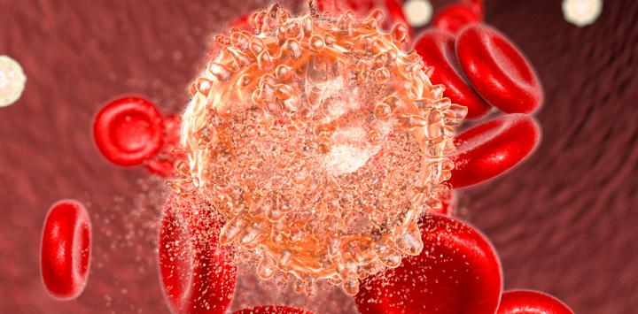 Leucemia promielocítica: enfoques oncogenéticos y moleculares en la era de la medicina de precisión