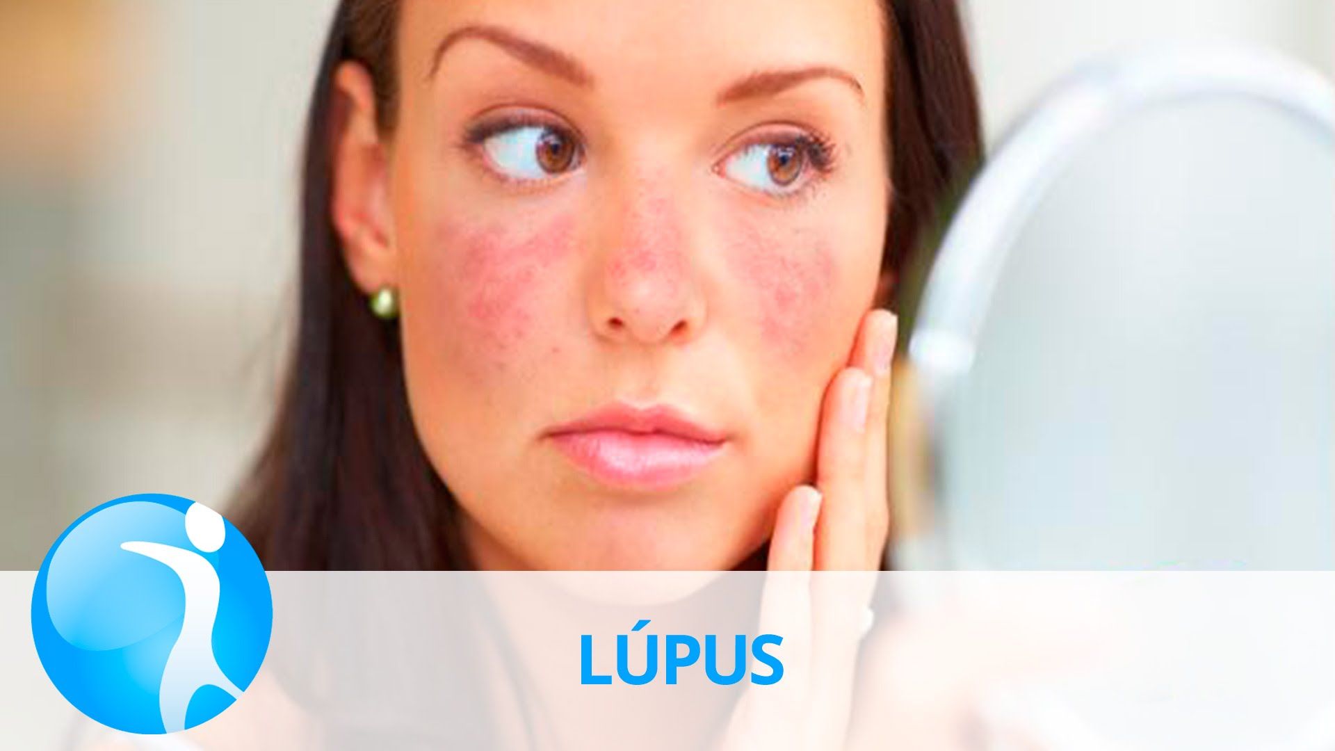 Los expertos anuncian avances significativos en la lucha contra el lupus
