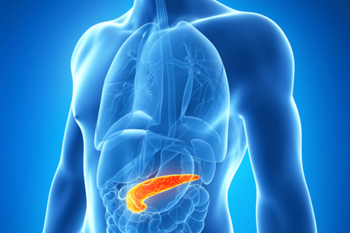Revelan el potencial antitumoral de la memantina en el cáncer de páncreas