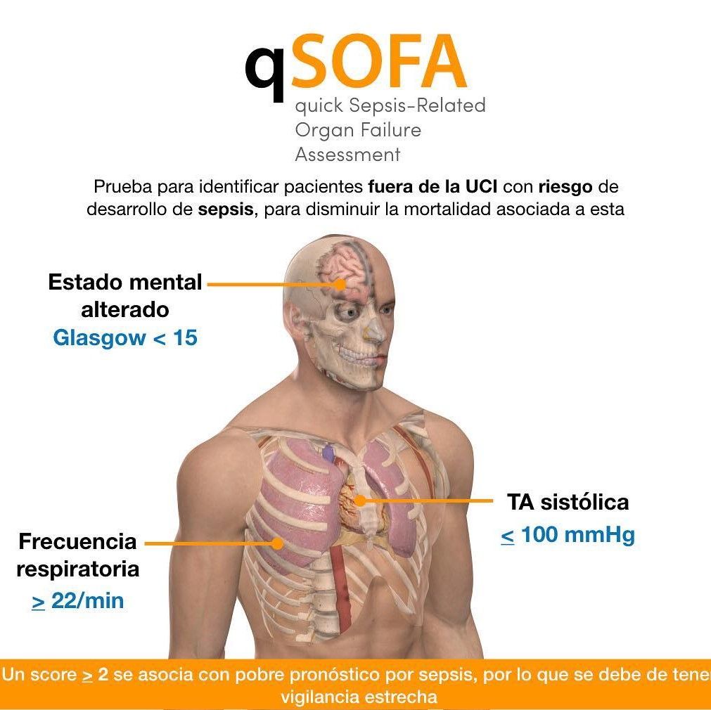 200 días de qSOFA, detección temprana de sepsis y disminución del riesgo