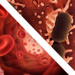 Síndrome urémico hemolítico asociado a diarrea sin trombocitopenia