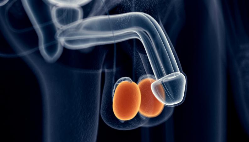 Experiencia actual en seguimiento activo para cáncer testicular estadio I