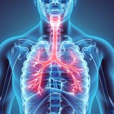 Hallazgos histopatológicos en síndrome de dificultad respiratoria aguda