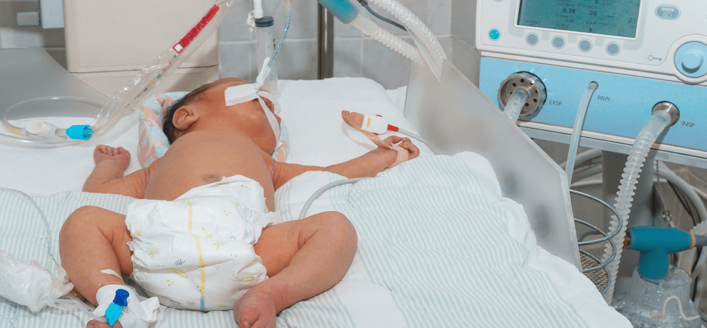 Factores de riesgo de fracaso de la ventilación mecánica no invasiva binivelada en niños 