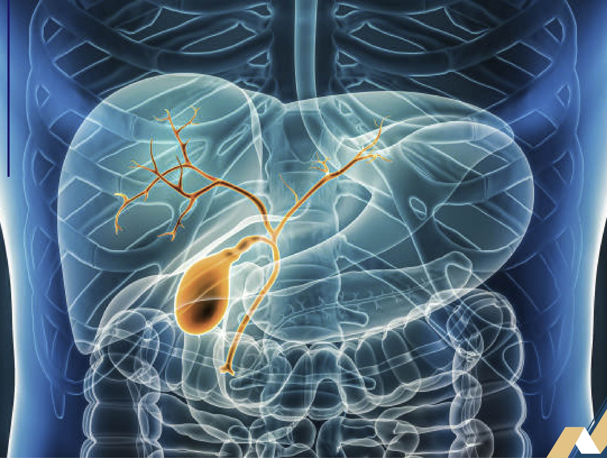 Estudian posibles opciones terapéuticas para la colestasis hepática