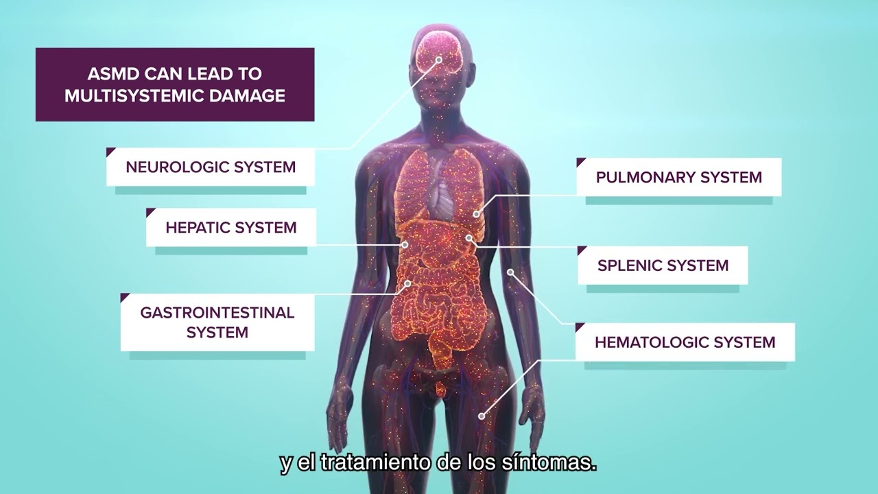 : Esperanza para los pacientes con ASMD: llega el primer tratamiento específico para esta enfermedad ultra-rara