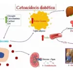 Cetoacidosis diabética en un paciente con acromegalia: Un desafío diagnóstico y terapéutico