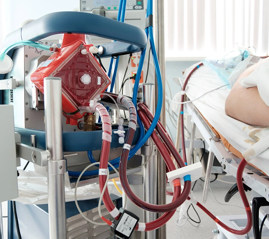 Soporte circulatorio con ECMO venovenoso en paciente con síndrome de reperfusión pulmonar secundario a tromboendarterectomía arterial pulmonar