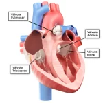 Se realiza con éxito una técnica innovadora de reparación valvular sin cirugía